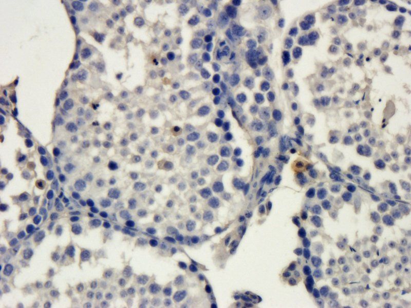 Melatonin Receptor 1B Rabbit Polyclonal Antibody