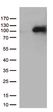 MEPCE Antibody
