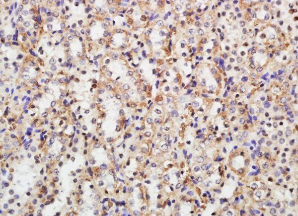 MFF Rabbit Polyclonal Antibody