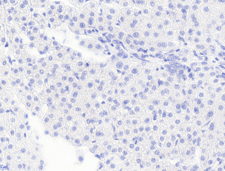 Monoglyceride Lipase Antibody