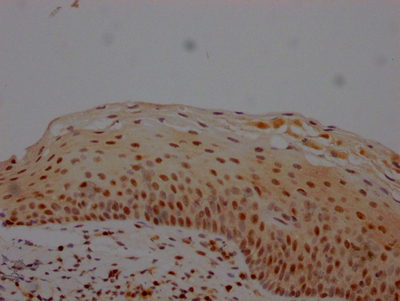 MGMT Antibody