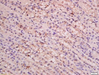 MGST1 Rabbit Polyclonal Antibody