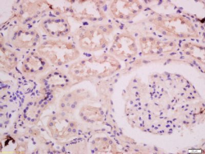 MGST1 Rabbit Polyclonal Antibody