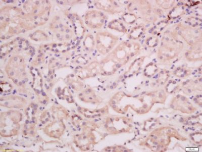 MGST1 Rabbit Polyclonal Antibody