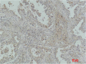 MICU1 Antibody