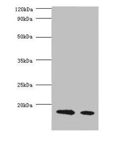 LGB Antibody