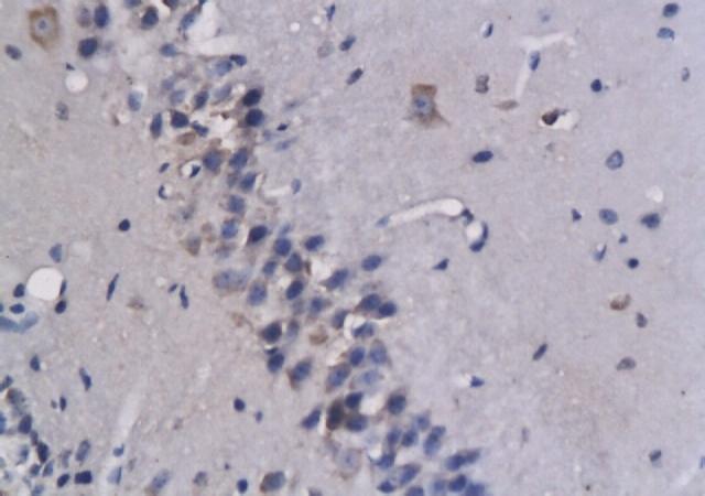 CCL3 Rabbit Polyclonal Antibody