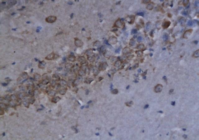 CCL3 Rabbit Polyclonal Antibody