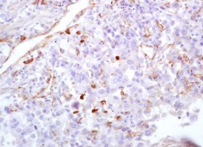 CCL3 Rabbit Polyclonal Antibody