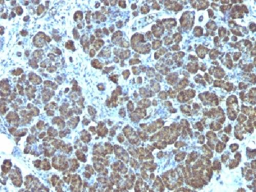 Mitochondria (Marker for Human Cells, Granular RCC s & Salivary Tumor Antibody