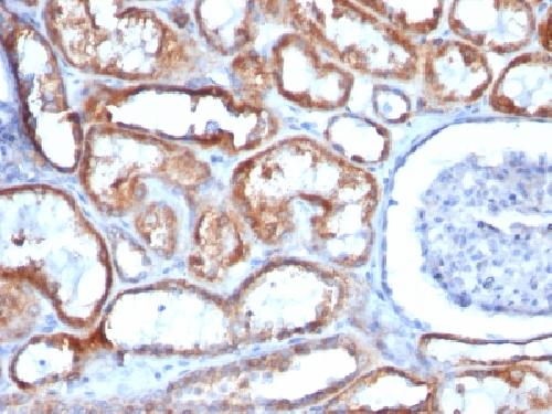 Mitochondria (Marker for Human Cells, Granular RCC s & Salivary Tumor Antibody