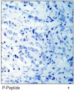 MKK3 (Phospho-Ser189) Antibody