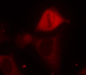 MKK3 (Phospho-Ser189) Antibody