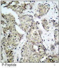 MKK6 (Phospho-Ser207) Antibody