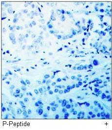 MKK6 (Phospho-Ser207) Antibody