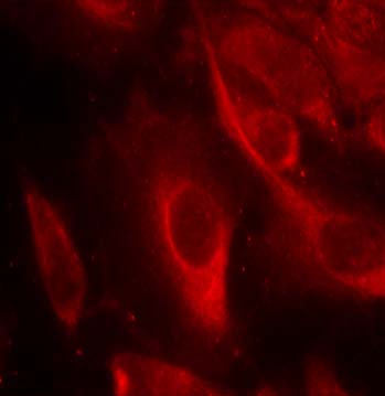 MKK6 (Phospho-Ser207) Antibody