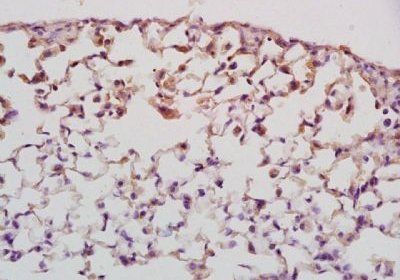 Mkl1 Rabbit pAb