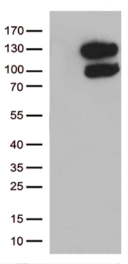 MYL6B Antibody