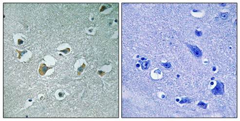 MLK1/2 (Phospho-Thr312/266) Antibody