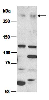 MLL2 (N) Antibody, Rabbit Polyclonal