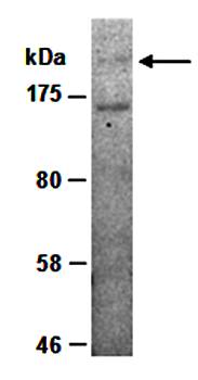 MLL5 (N) Antibody, Rabbit Polyclonal