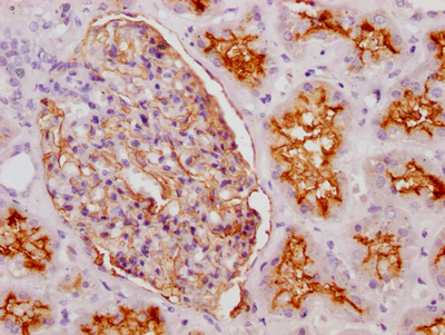 MME Antibody