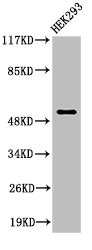 MMP1 Antibody