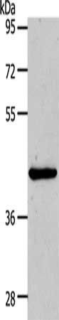 MMP13 Antibody