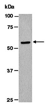 MMP13 (N) Antibody, Rabbit Polyclonal
