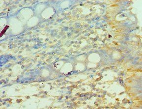MMP14 Antibody