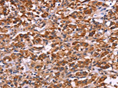 MMP14 Antibody