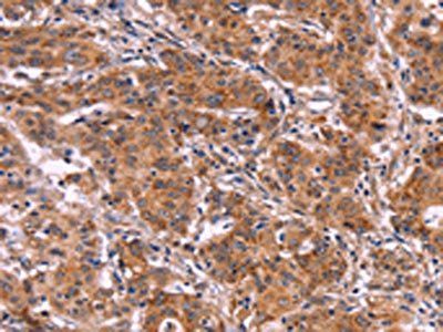 MMP14 Antibody