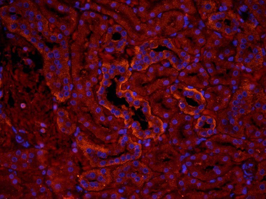 MMP15 Rabbit Polyclonal Antibody