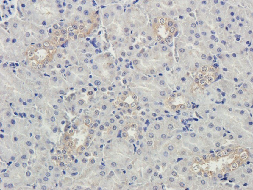 MMP15 Rabbit Polyclonal Antibody