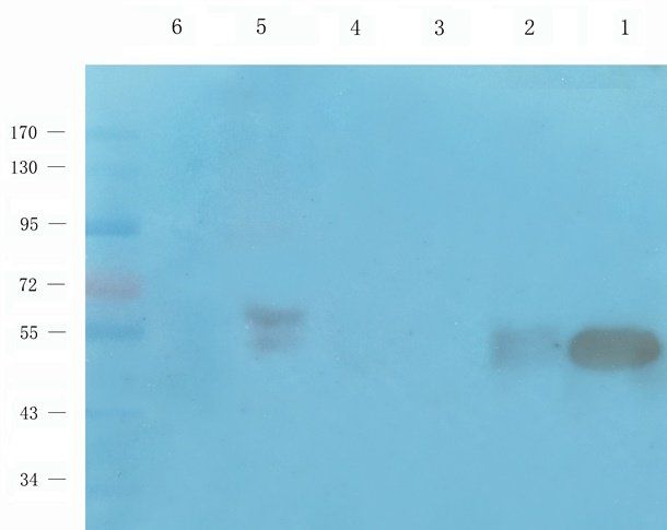 MMP15 Rabbit Polyclonal Antibody