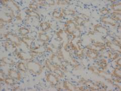 Matrix metalloproteinase-16 MMP16/16 Rabbit Polyclonal Antibody