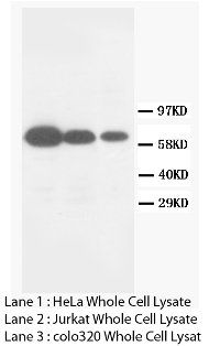 Matrix metalloproteinase-16 MMP16/16 Rabbit Polyclonal Antibody