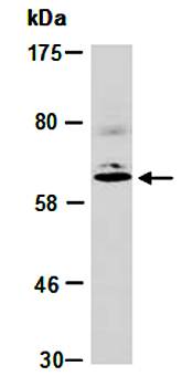 MMP16 (C1) Antibody, Rabbit Polyclonal