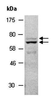 MMP17 (M) Antibody, Rabbit Polyclonal