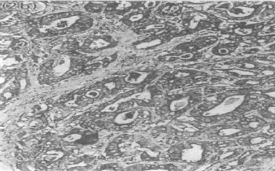 Mouse Human Matrix Metalloproteinase 2 (MMP2) Antibody