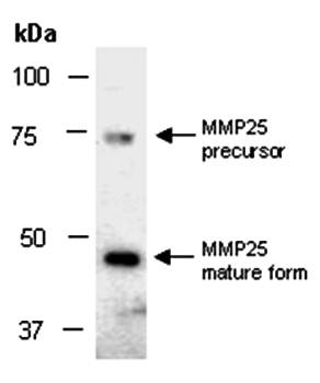 MMP25 (C) Antibody, Rabbit Polyclonal