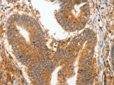 MMP28 Antibody