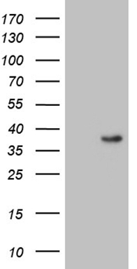 MMP3 Antibody