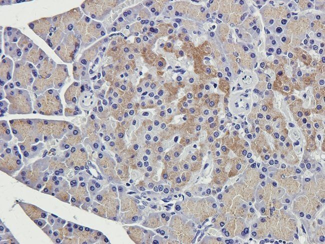 MMP7 Rabbit Polyclonal Antibody