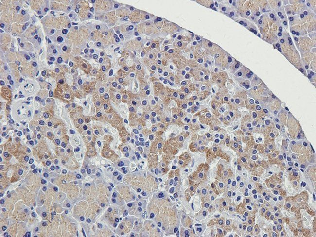 MMP7 Rabbit Polyclonal Antibody