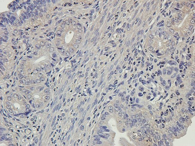MMP7 Rabbit Polyclonal Antibody