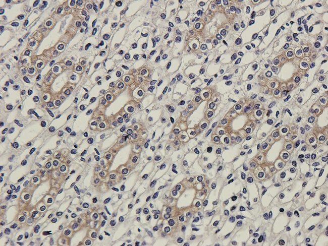 MMP7 Rabbit Polyclonal Antibody
