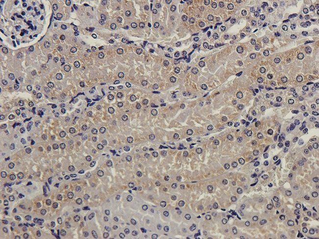 MMP7 Rabbit Polyclonal Antibody