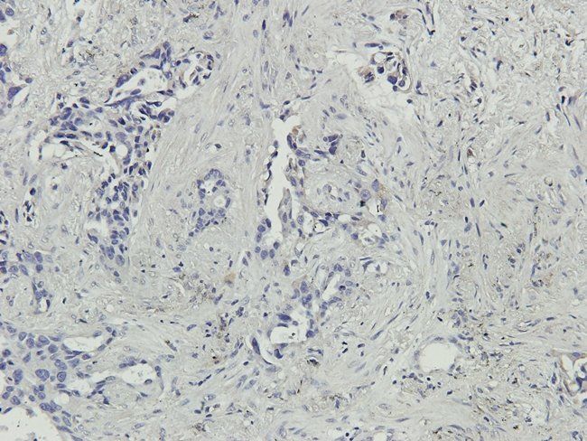 MMP7 Rabbit Polyclonal Antibody