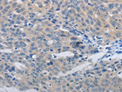 MMP8 Antibody